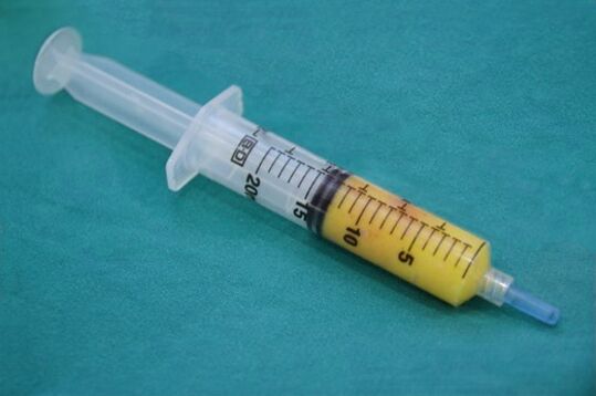 Seringa com tecido adiposo para lipofilling